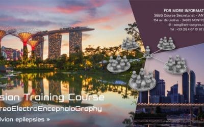 3rd Asian Training Course on SteroeElectroEncephaloGraphy, en avril 2019 à Singapour